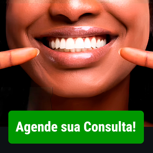Lentes Dentais e Clareamento: cuide do seu sorriso com quem entende do assunto!